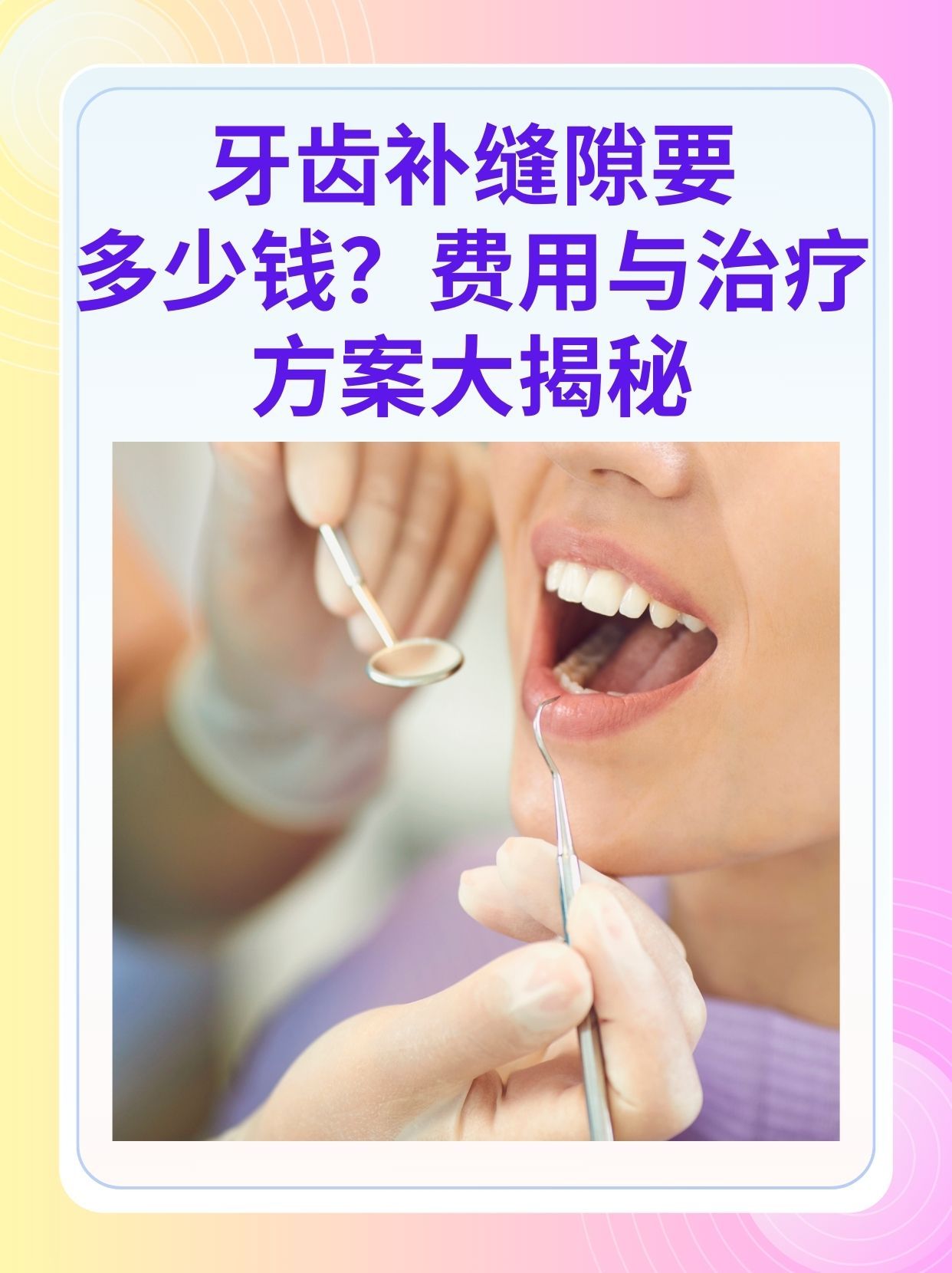 朝阳补牙医保可以报销吗(补牙医保可以报销吗 哪些可以报销呢)